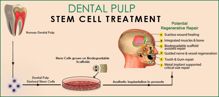 نتيجة الصورة للخلايا الجذعية لطب الأسنان